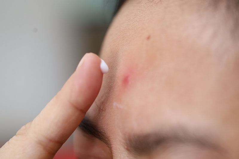 Lấy một lượng kem vừa đủ bằng hạt đầu ra đầu ngón tay, thoa đều vào vùng da bị thâm mụn, massage nhẹ nhàng.