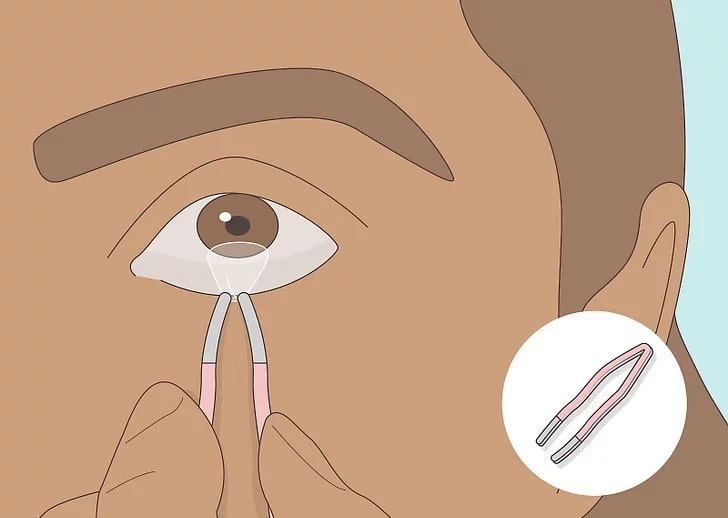 Cách tháo lens bằng dụng cụ hỗ trợ