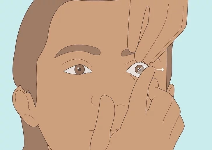 Cách lấy lens ra khỏi mắt bằng tay