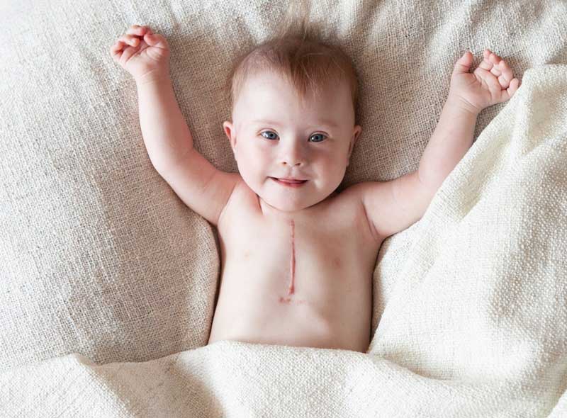 Kem trị sẹo Contractubex có thể sử dụng cho trẻ em trên 1 tuổi dưới sự giám sát của bố mẹ.