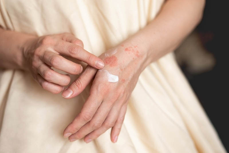 Tác dụng phụ thường gặp khi dùng thuốc Contractubex 50g là nổi ban đỏ, ngứa.