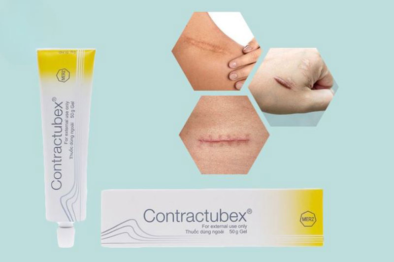 Contractubex 10g thường dùng điều trị sẹo lồi
