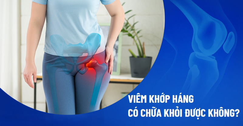 Viêm khớp háng có chữa được không