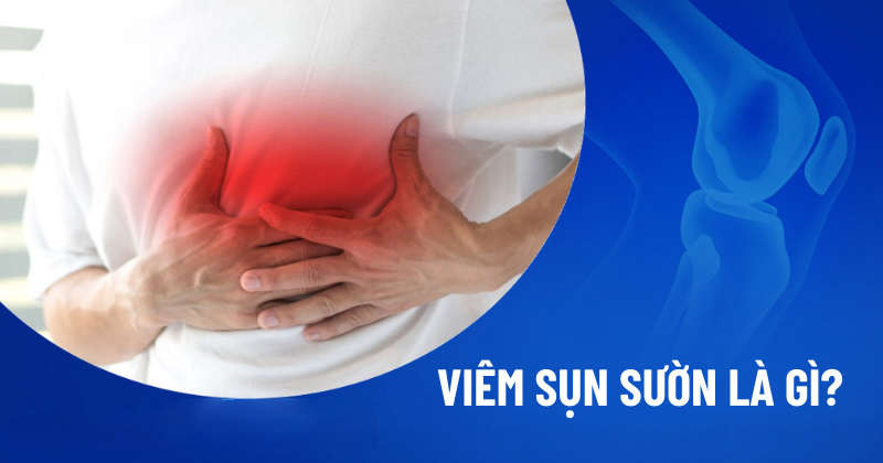 Viêm sụn sườn