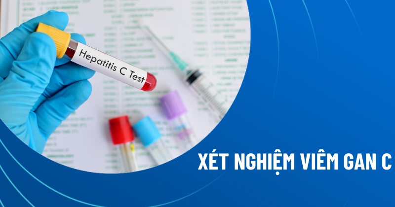 xét nghiệm viêm gan c