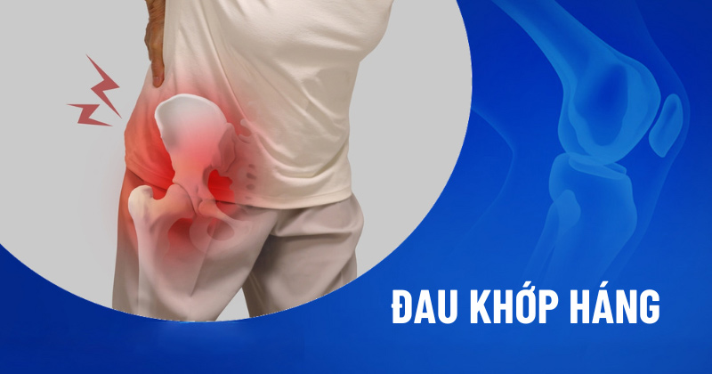 Đau khớp háng