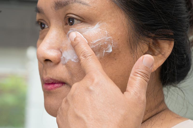 bôi kem trị nám lâu năm tại nhà