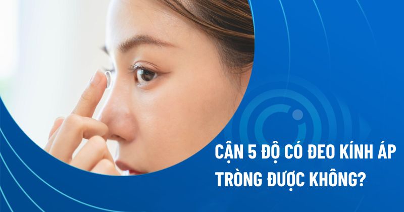 Cận 5 độ có đeo kính áp tròng được không