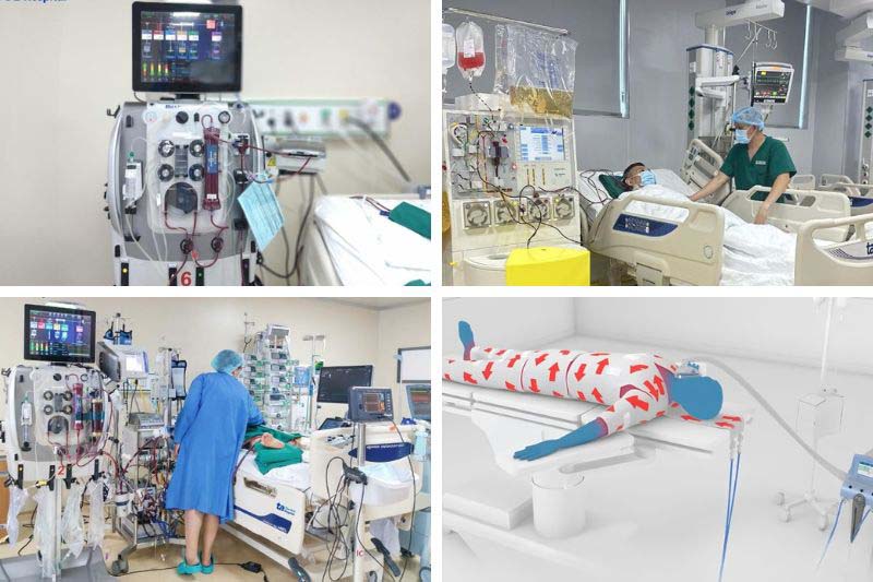 Cấp cứu đột quỵ tại phòng khám Tâm Anh quận 7