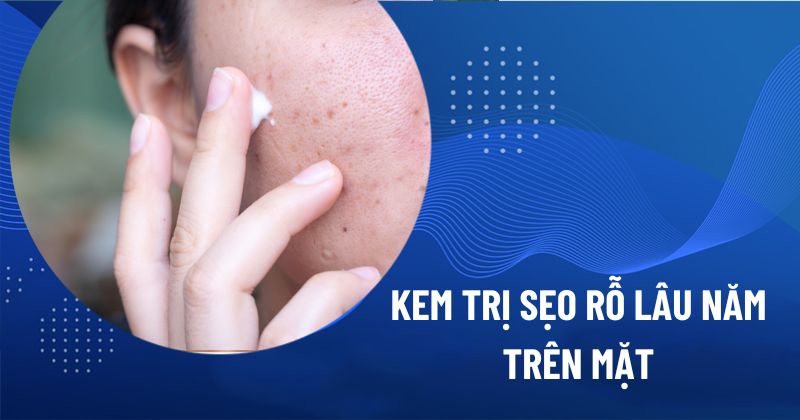 kem trị sẹo rỗ tốt nhất hiện nay