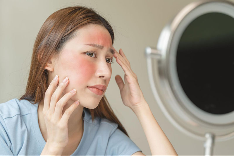 Lăn kim có thể gây tác dụng phụ như sưng, đỏ da tại chỗ tiêm.