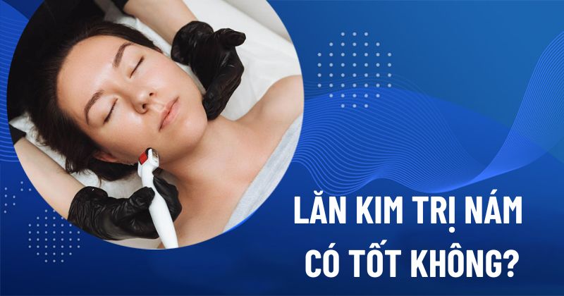 Lăn kim trị nám da có tốt không?