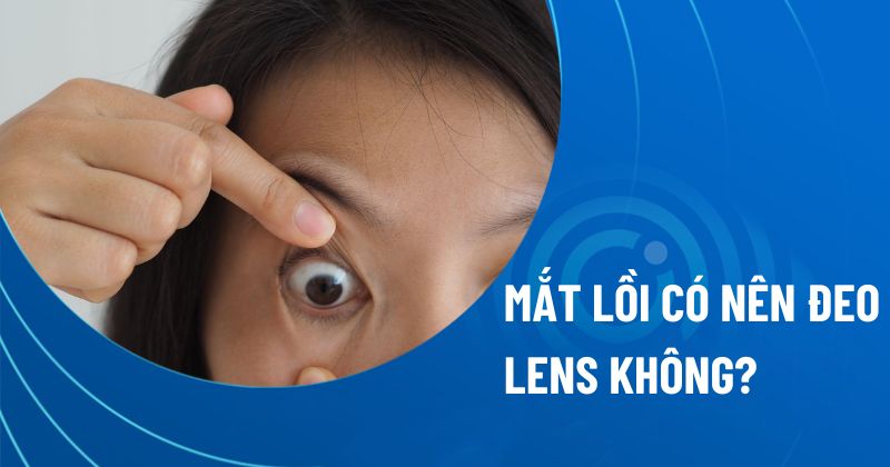 Mắt lồi có nên đeo lens không