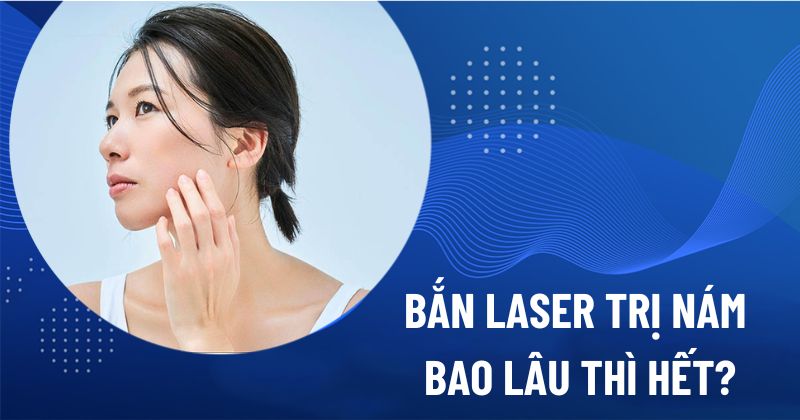 bắn laser trị nám bao lâu thì hết