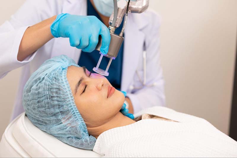 bắn laser trị nám da mặt vùng má