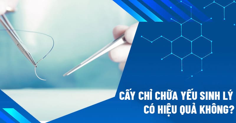 Cấy chỉ chữa yếu sinh lý