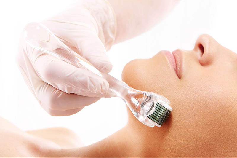 Lăn kim giúp kích thích sản sinh collagen và elastin