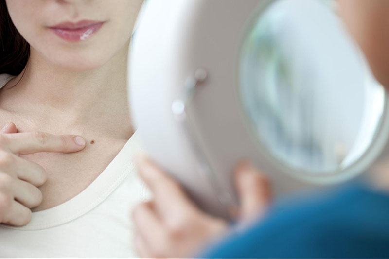 lợi ích của việc dùng laser điều trị nám da