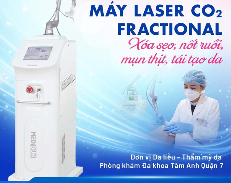 máy bắn laser co2 fractional