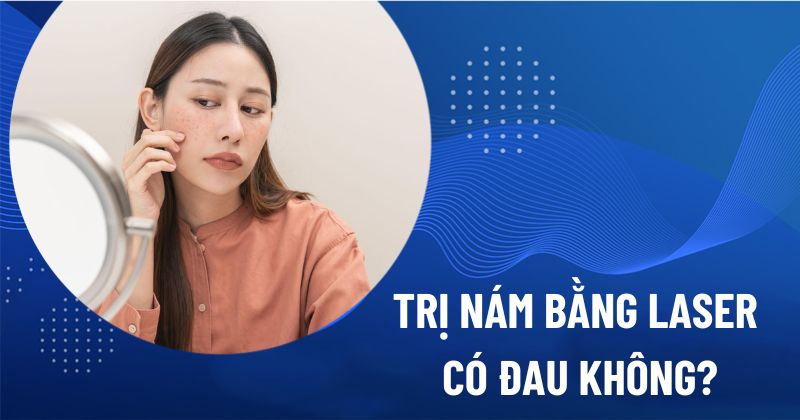trị nám bằng laser có đau không