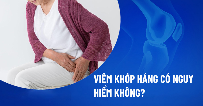 Viêm khớp háng có nguy hiểm không