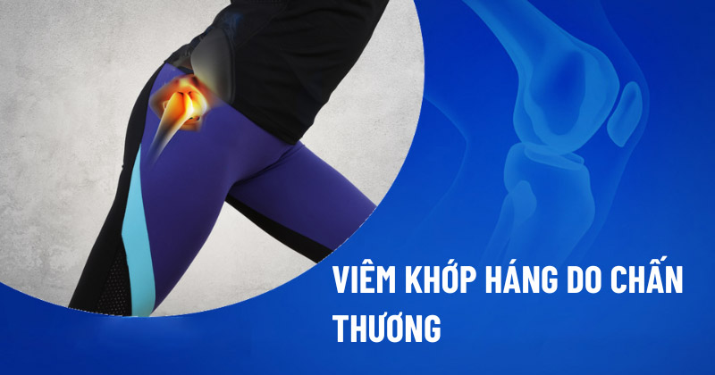Viêm khớp háng do chấn thương