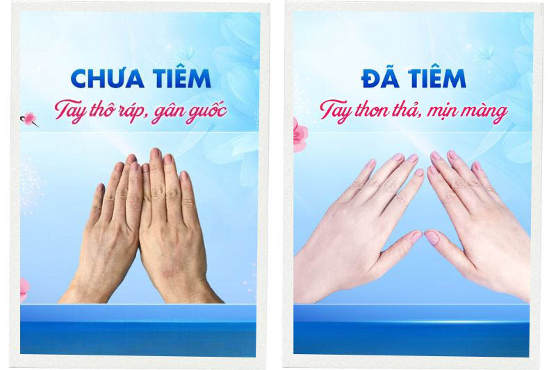 Công nghệ tiêm giúp da trẻ đẹp tại Tâm Anh