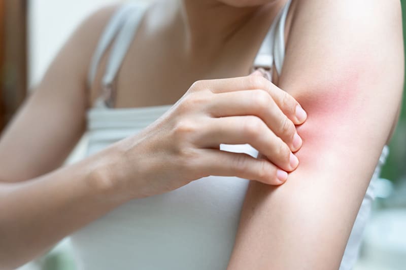 nếu bị ngứa nổi mẩn đỏ khi uống nước lá vối cần ngưng lại ngay