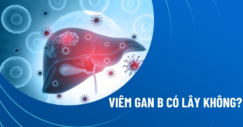 viêm gan b có lây không