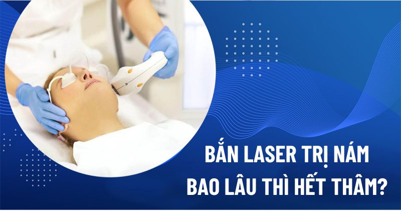bắn laser trị nám bao lâu thì hết thâm