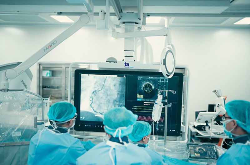 chụp mạch dsa siêu âm chuyên sâu