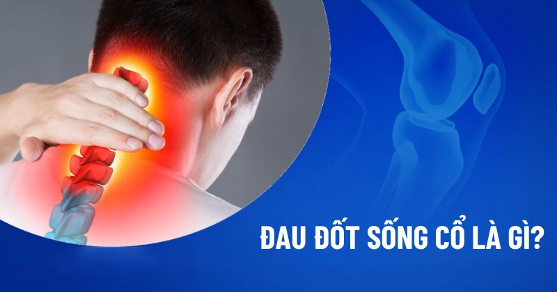 Đau đốt sống cổ