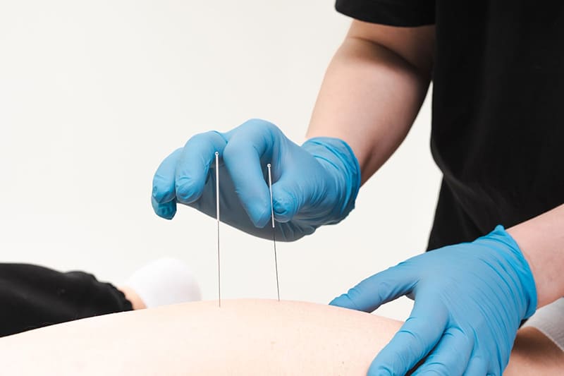 người bị mất ngủ có thể dẫn đến cơ sở uy tín để châm cứu