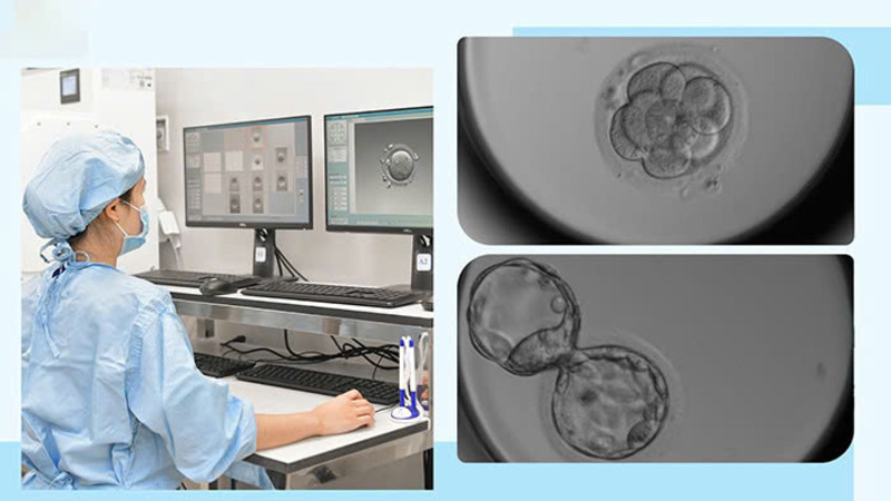 phần mềm phân tích phôi áp dụng trí tuệ nhân tạo