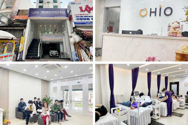 Phòng khám chuyên khoa da liễu Quận 3 Hồ Chí Minh OHIO