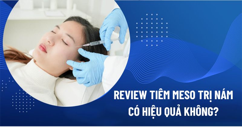 review tiêm meso trị nám da