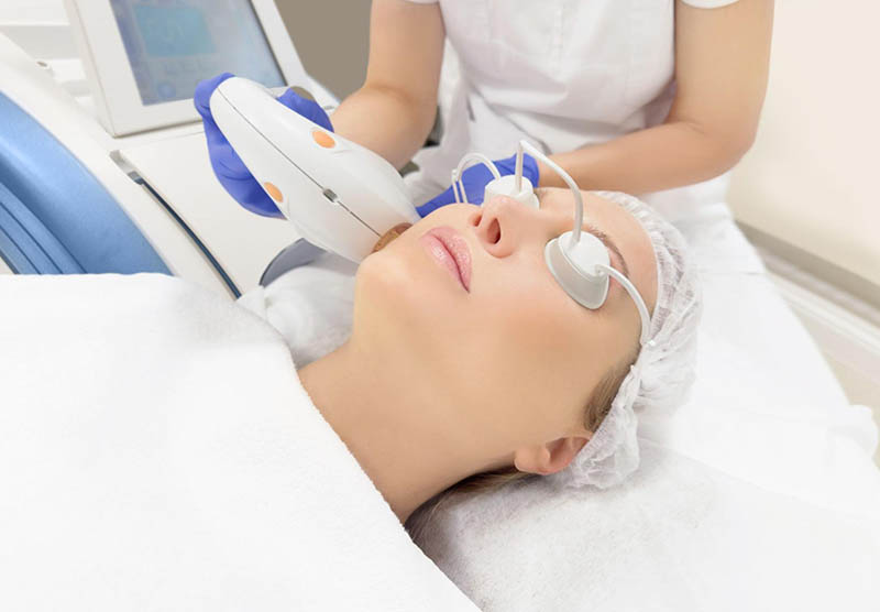 so sánh vi kim và laser trị nám