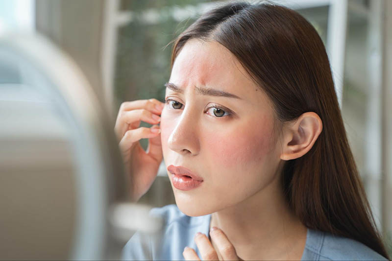 tác dụng phụ sau khi tiêm meso trị nám