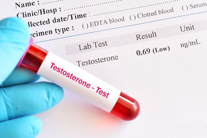 xét nghiệm giúp chẩn đoán tình trạng thiếu hoặc thừa testosterone