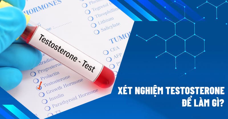 Xét nghiệm testosterone để làm gì?