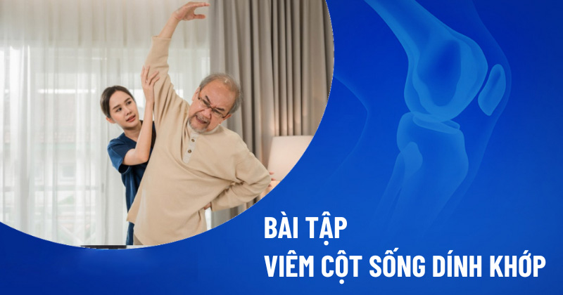 Bài tập viêm cột sống dính khớp