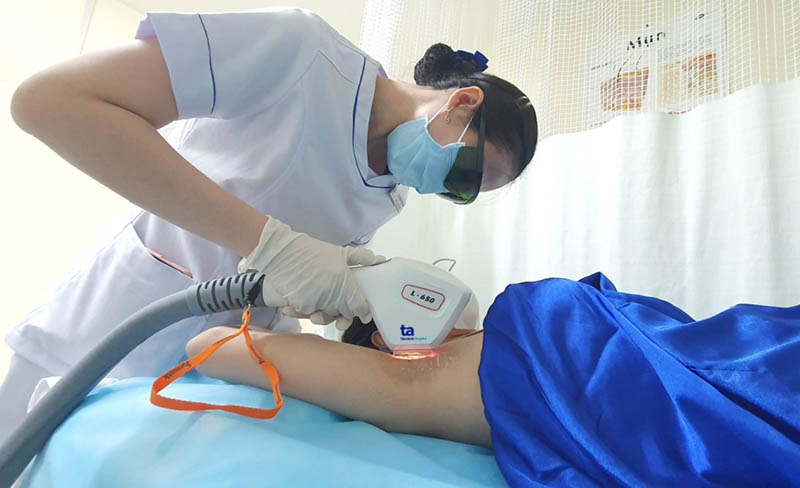 công nghệ ipl khử thâm nách hiệu quả