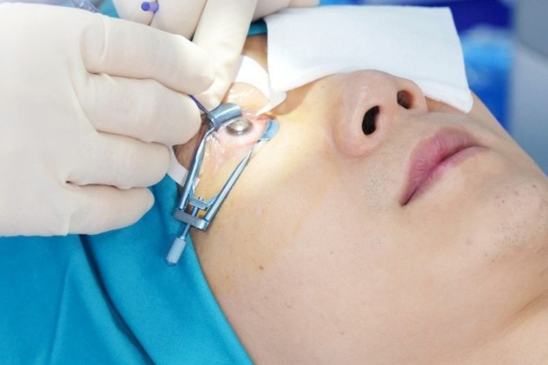 Bệnh loạn thị có chữa khỏi được không? Mắt loạn thị có chữa được không? Công nghệ SMILE Pro có thể triệt tiêu độ loạn lên đến 5 độ. - Ảnh: BVĐK Tâm Anh.