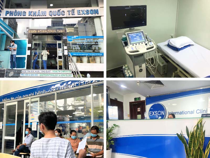 Phòng khám Quốc tế Exson