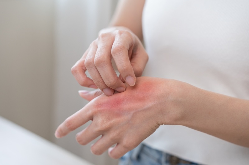 tác dụng phụ alfavir tablet 25mg