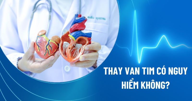 Phẫu thuật thay van tim có nguy hiểm không? Có rủi ro gì?