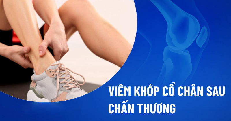 Viêm khớp cổ chân sau chấn thương