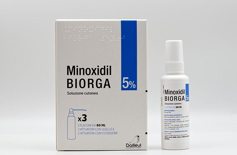 chữa hói đầu bằng minoxidil