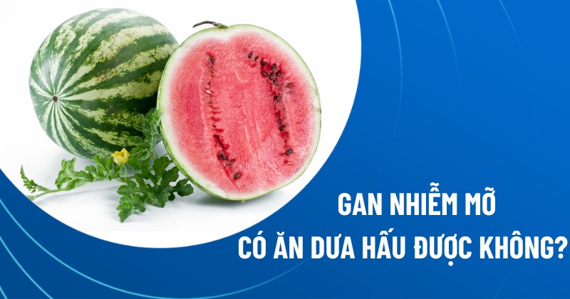 gan nhiễm mỡ có ăn dưa hấu được không