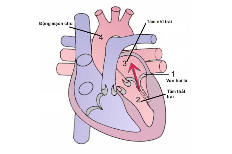 hở van 2 lá từ thất trái đến nhĩ trái